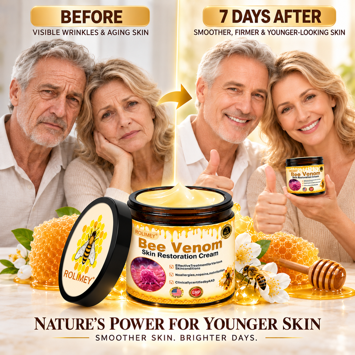 ✅✅Official Brand Shop丨Rolimey® Bee venom Pro Comprehensive Cream—Tightening for Skin Types
