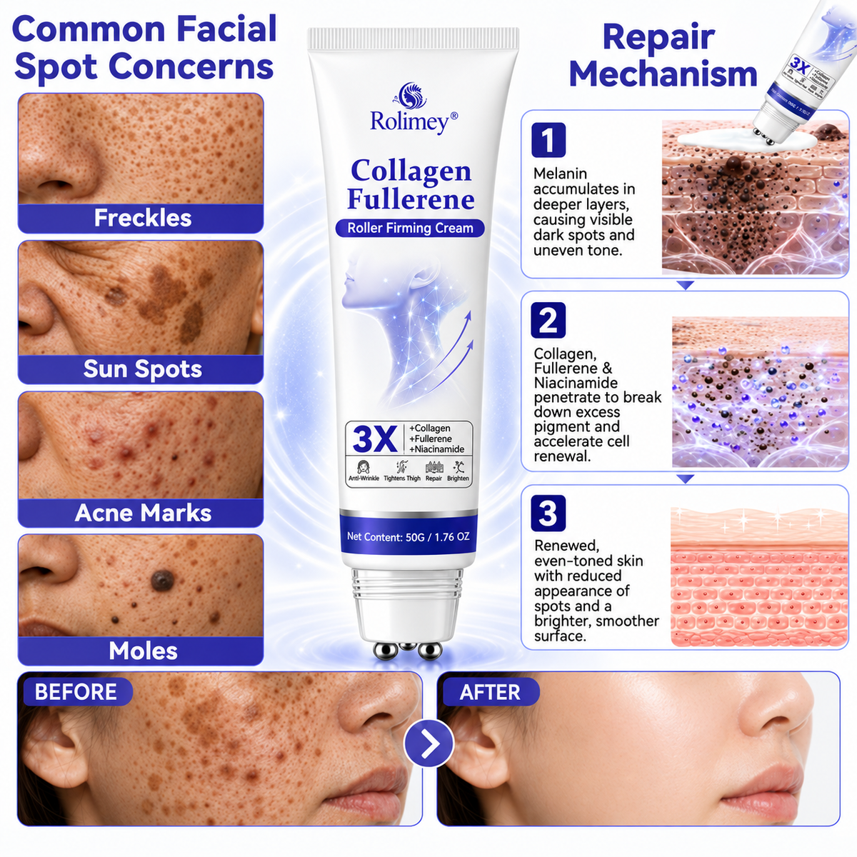 Rolimay® 𝐂𝐨𝐥𝐥𝐚𝐠𝐞𝐧 & 𝐅𝐮𝐥𝐥𝐞𝐫𝐞𝐧𝐞 𝐑𝐨𝐥𝐥𝐞𝐫 𝐅𝐢𝐫𝐦𝐢𝐧𝐠 𝐂𝐫𝐞𝐚𝐦⏰Enjoy an exclusive 30% discount⏰