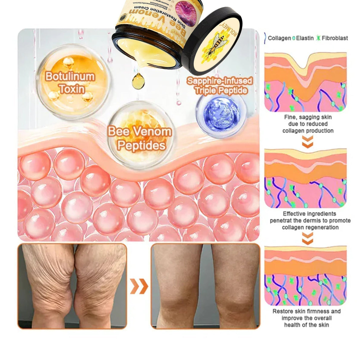 ✅✅Official Brand Shop丨Rolimey® Bee venom Pro Comprehensive Cream—Tightening for Skin Types